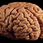 Исследование: Кокаин заставляет клетки мозга самоуничтожаться