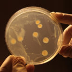 Ученые выяснили, как охотятся на собратьев хищные бактерии