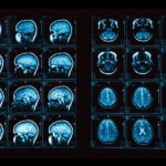 Ученые «читают мысли» при помощи МРТ