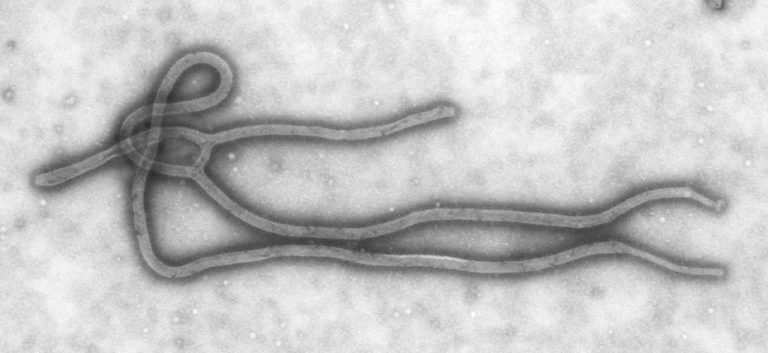 Ebola_Virus_TEM_PHIL_1832_lores (1)