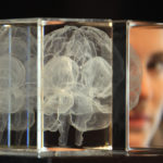 Структура мозга предскажет склонность к риску