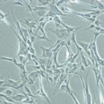 Ученые впервые превратили клетки кожи в лейкоциты