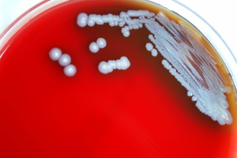 gram-negative-burkholderia-pseudomallei-bacteria-which-was-grown-on-a-medium-of-sheeps-blood-agar