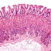normal_gastric_mucosa_low_mag