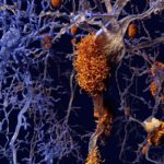 Ученые нашли факторы риска болезни Альцгеймера за пределами мозга