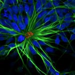 Ученые вернули молодость стволовым клеткам нервной ткани