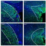 Биоинженерный гель восстановил нейроны мышей после инсульта