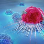 Искусственный интеллект предскажет развитие раковой опухоли