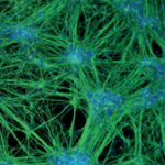 Клетки крови человека превратили в стволовые клетки нервной системы