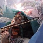 Женщина играла на скрипке, пока врачи удаляли опухоль из ее мозга