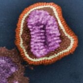 Вирусная частица, снятая под электронным микроскопом /© CDC, Frederick Murphy