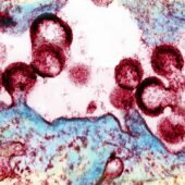 Вирионы ВИЧ высвобождаются из инфицированной клетки / ©NIAID, NIH