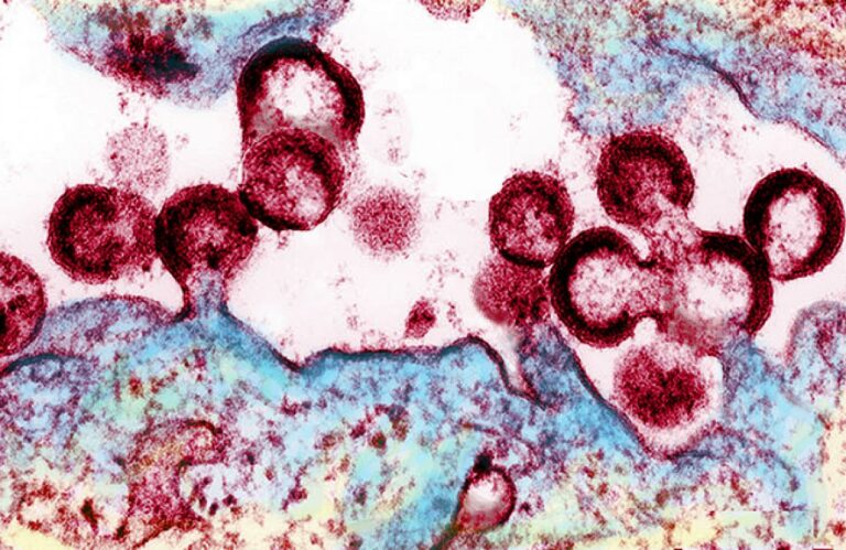 Вирионы ВИЧ высвобождаются из инфицированной клетки / ©NIAID, NIH