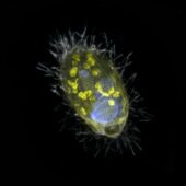 Бактериальные клетки внутри плагиопилиды окрашены желтым