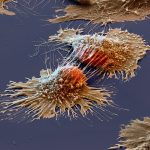 Устойчивость раковых клеток легкого к препаратам зависит от витамина В1
