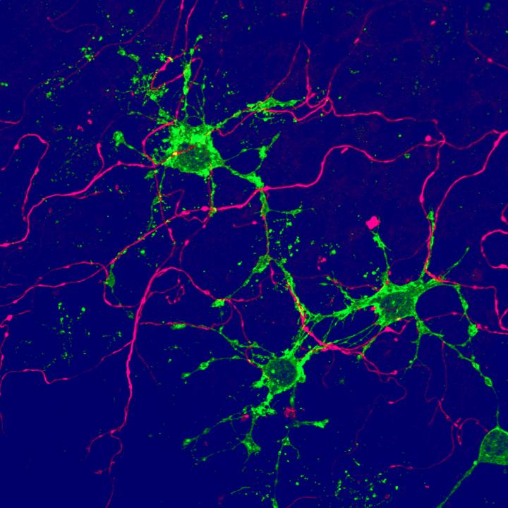 Новый тип глиальных клеток (зеленый) контактирует с нервными клетками (розовый) / ©Базельский университет