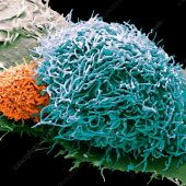 Лимфоцит атакует раковую клетку. Фото сделано при помощи сканирующей электронной микроскопии / ©Іс Science Photo Library