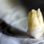 Ученые разработали наноботов для лечения зубных каналов