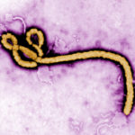 Вирус Эбола нашли в глазу уже вылечившегося человека