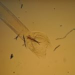 Ученые: черви-паразиты выбирают свою жертву по запаху