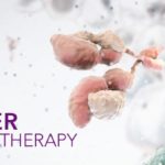 Иммунотерапия рака – научный прорыв 2013 года
