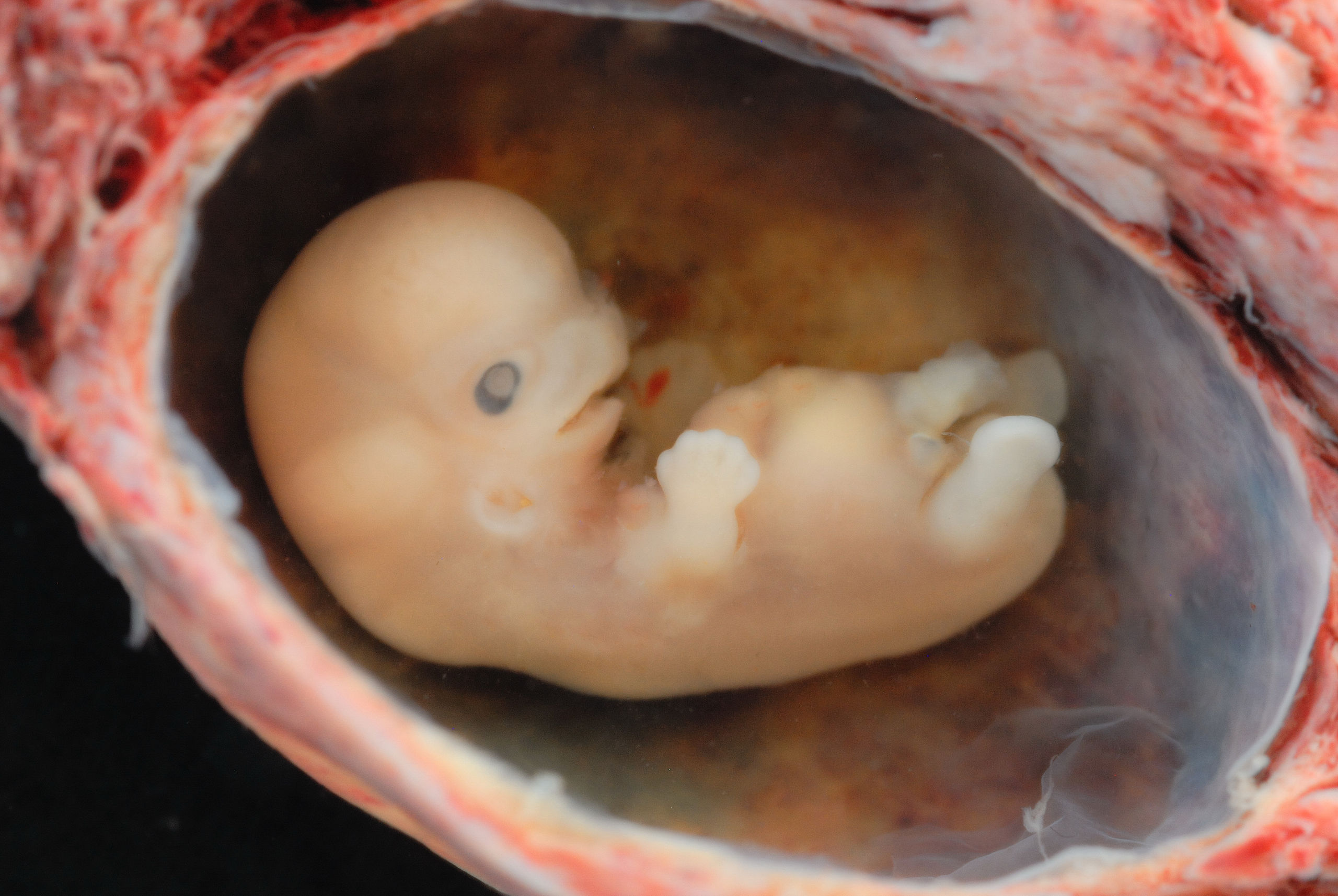 Embrion calidad b