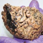 В древнем черепе нашли неповрежденный человеческий мозг