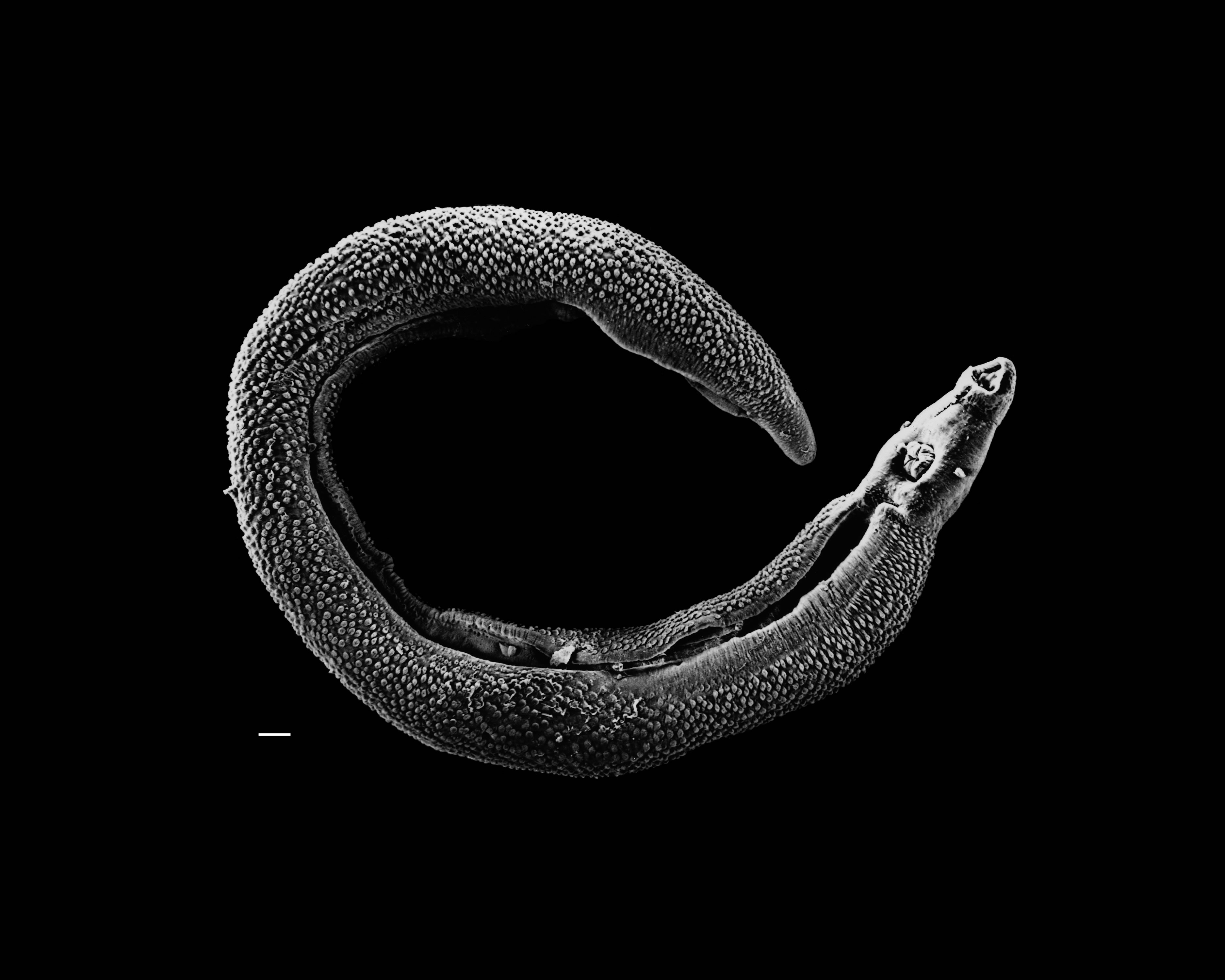 Schistosoma_20041-300