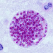 Toxoplasma_gondii_tissue_cyst_in_mouse_brain