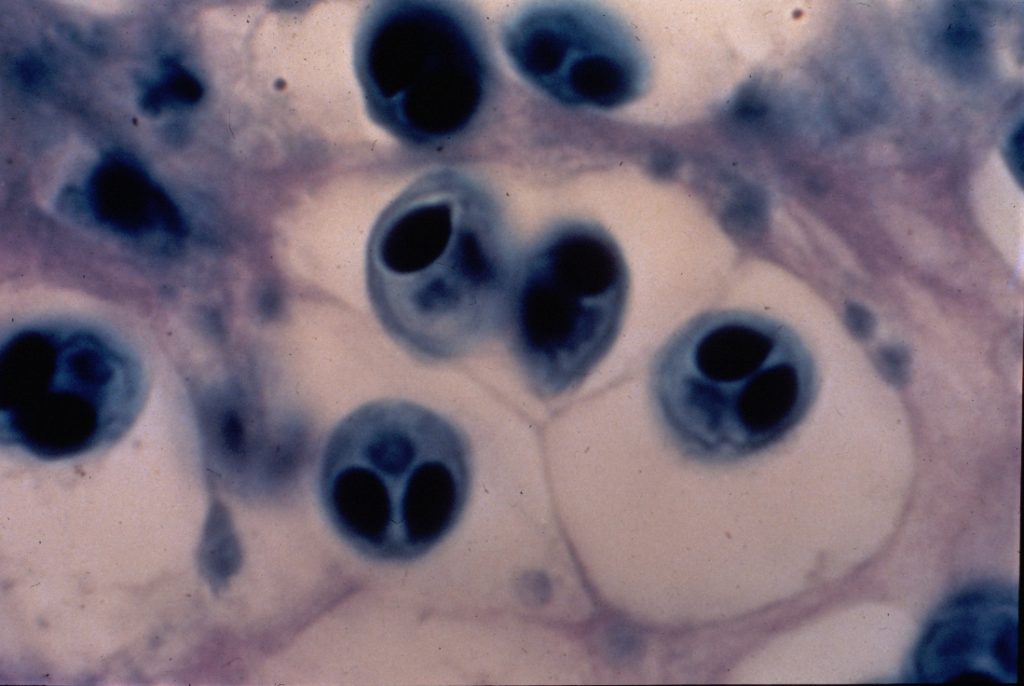 Whirling_disease_pathology