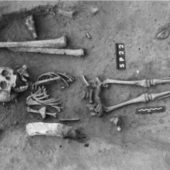 ancient-burial-down-syndrome