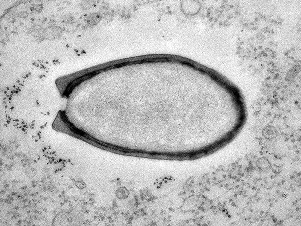 new-class-of-virus-discovered-pandoravirus_69452_600x450