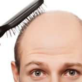 new-cure-for-baldness-ftr