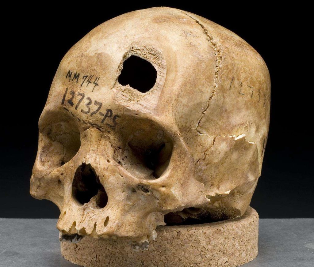 skull_sword_trauma