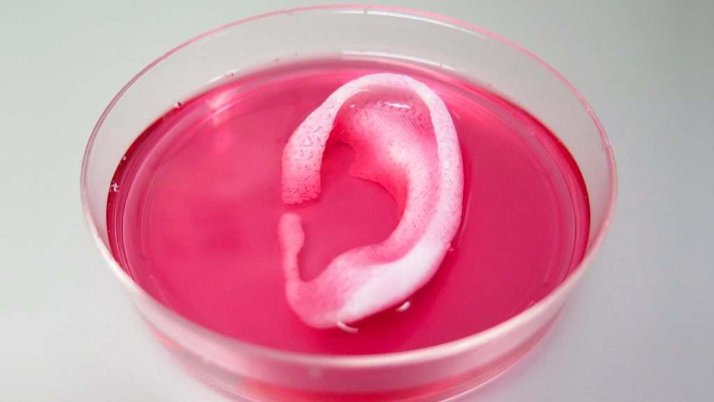 sn-ear
