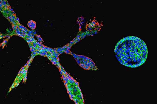 un-bra-lievable - breast cells grown in a petri dish
