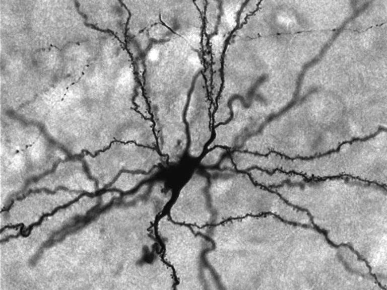 fmi_neuron_amygdala