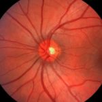 Google DeepMind будет диагностировать болезни глаз с помощью искусственного интеллекта