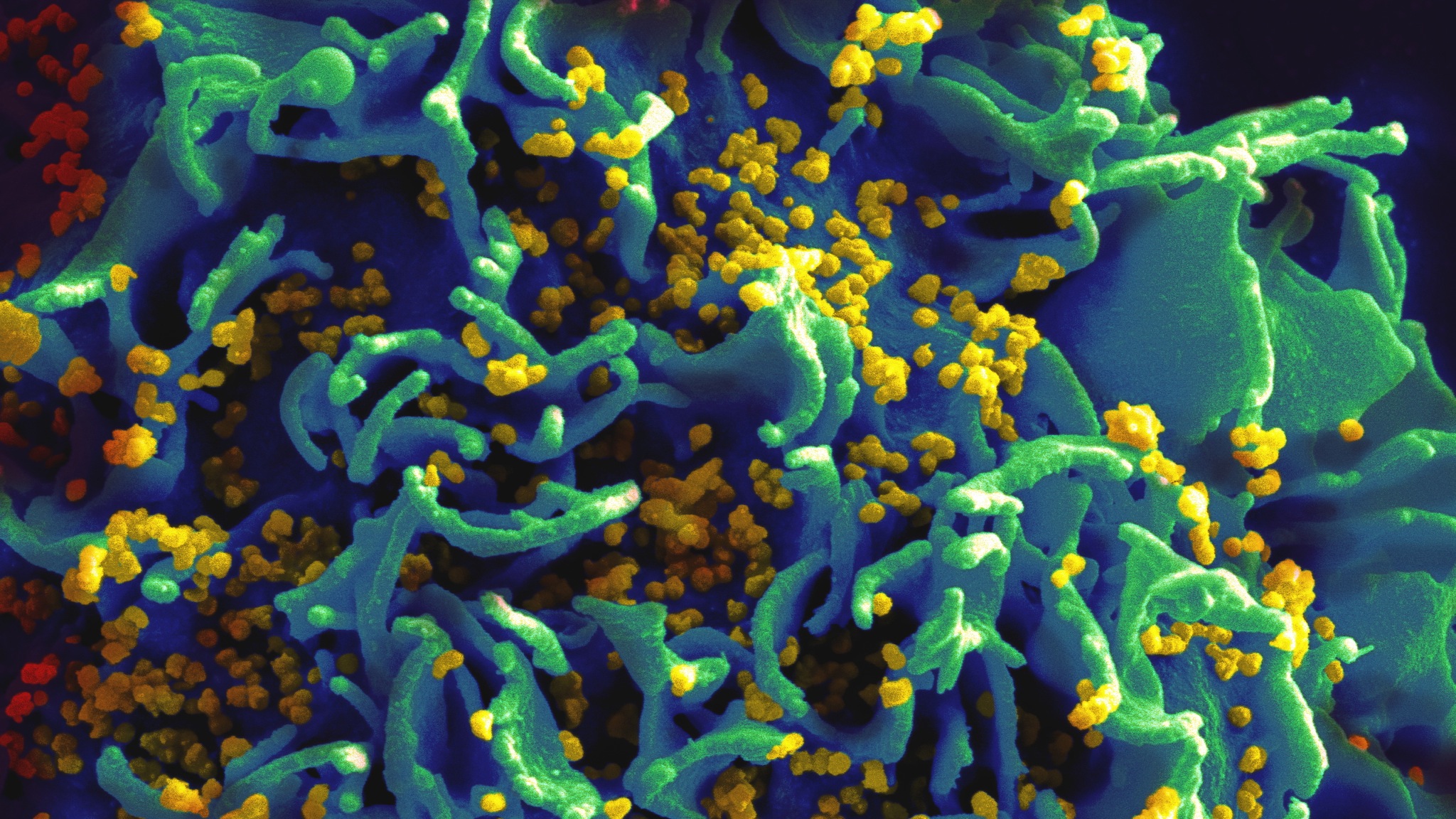 hiv-infected-h9-t-cell