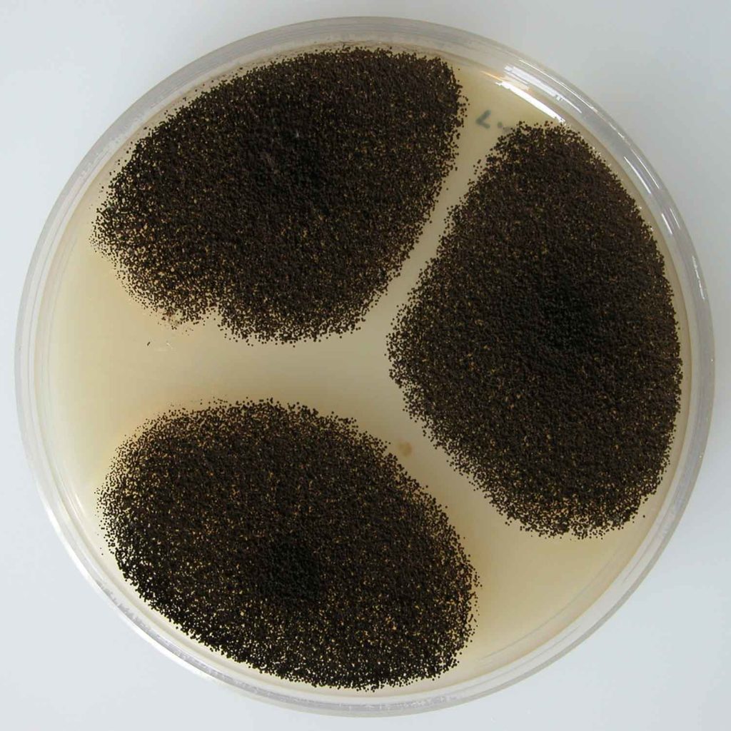 394230-aspergillus-nmeaa