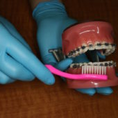 brush-teeth-with-braces