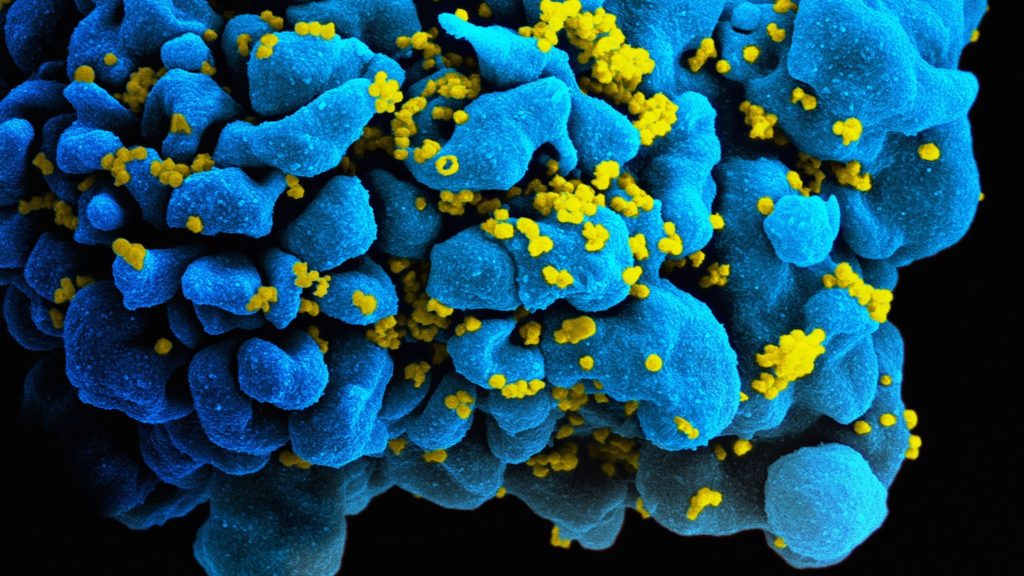 hiv_h9_t-cell