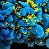 hiv_h9_t-cell