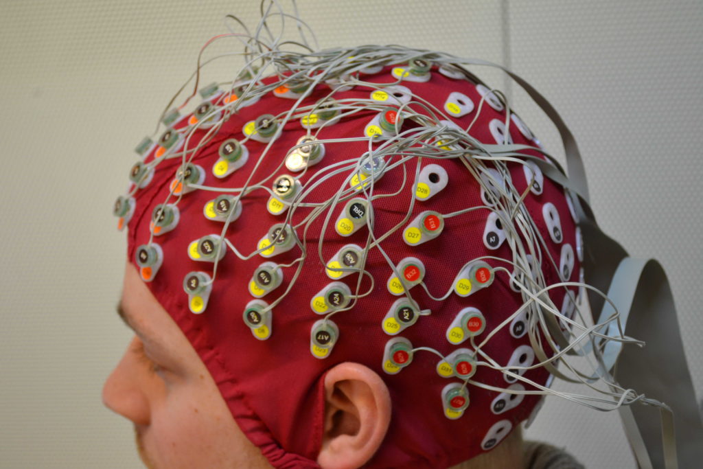 eeg-03
