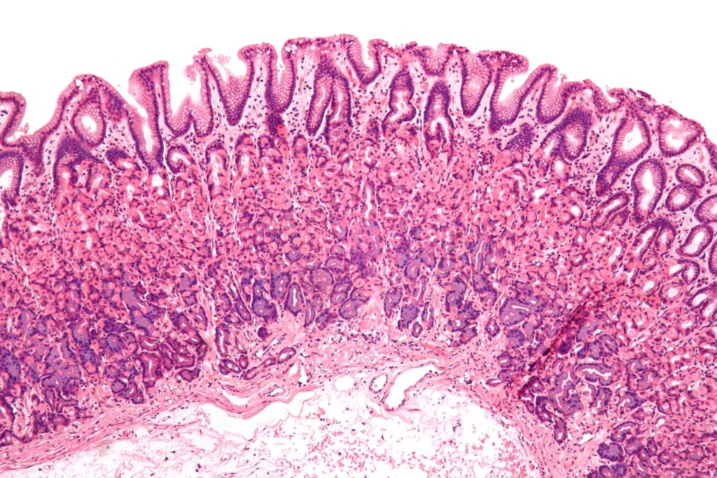 normal_gastric_mucosa_low_mag