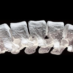 Предложены универсальные твердеющие чернила для 3D-печати костей