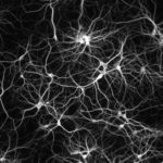 «Эндоцитозную теорию» болезни Альцгеймера доказали на нейронах