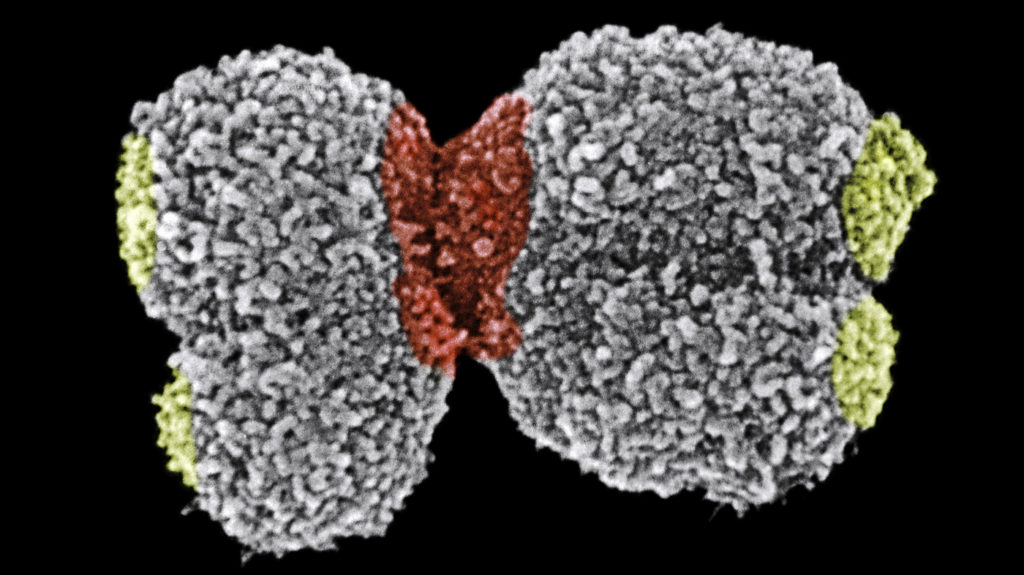 telomereyellow_wide-64eb4d9dc1a970130b464b81721e553ca9b9dd88