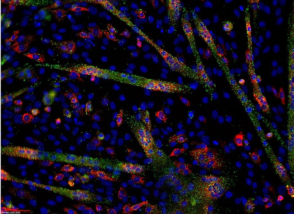 1024px-microrna_and_mrna_visualization_in_differentiating_c1c12_cells
