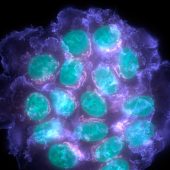 breast-cancer-cells-data